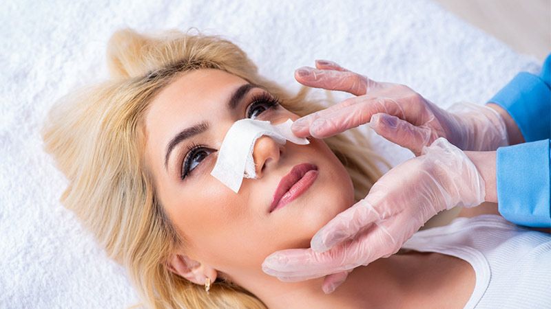 عمل ترمیمی زیبایی (رینوپلاستی)