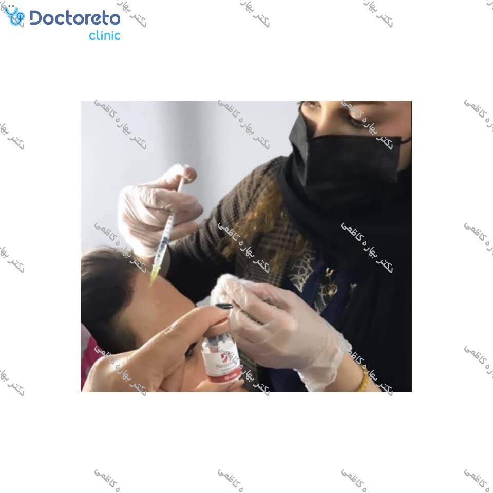 تزریق بوتاکس صورت (پیشانی، خط اخم، پنجه کلاغی)💉