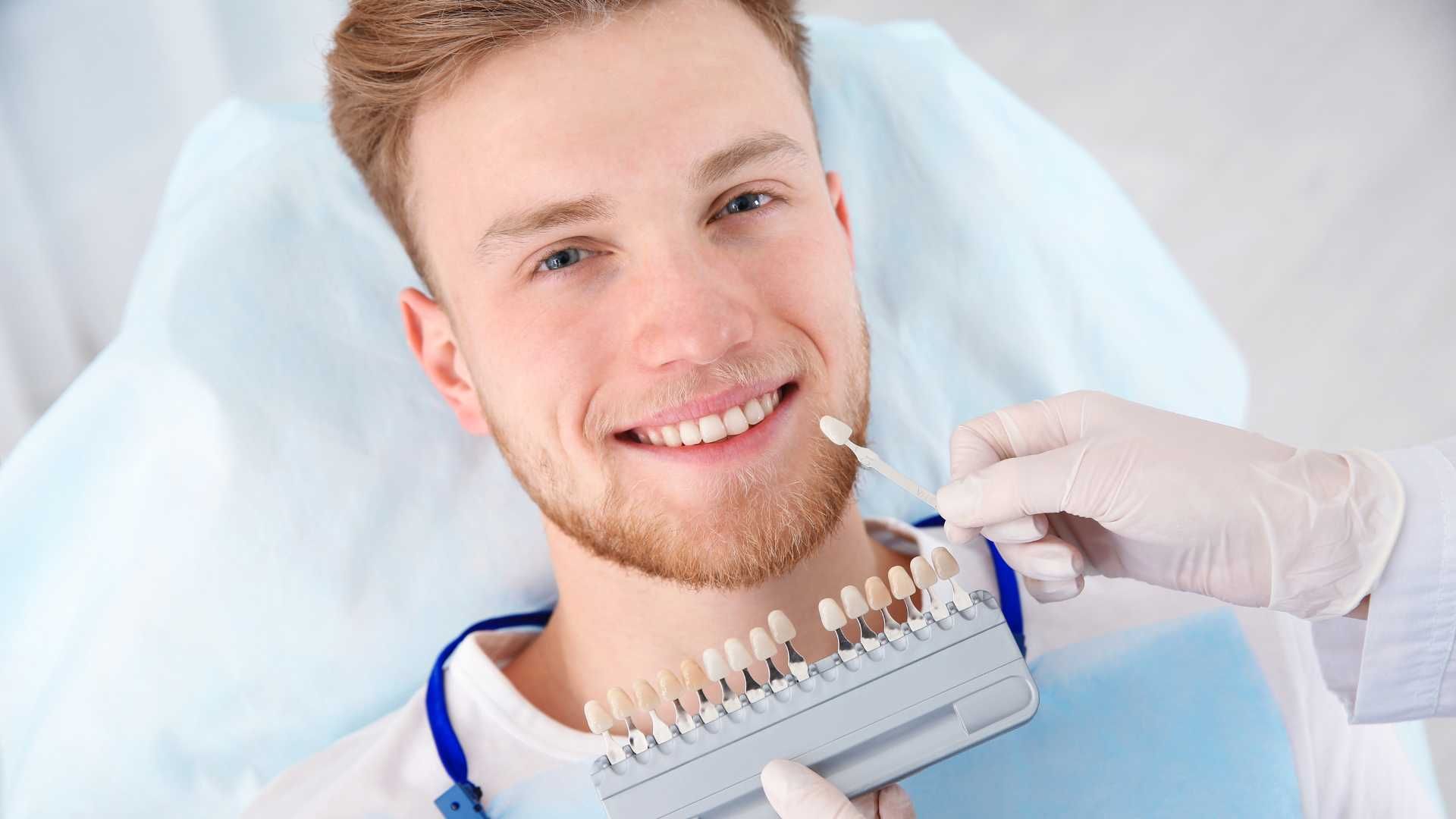 روکش دندان آنله سرامیکی (هر واحد)