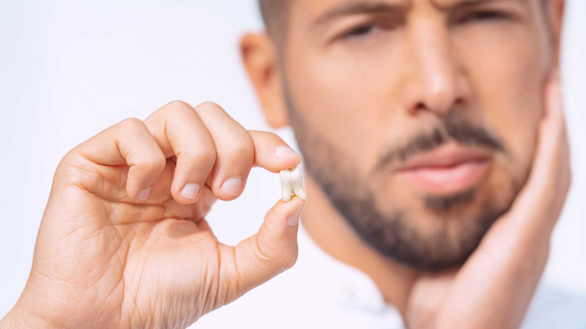 جراحی دندان عقل نهفته