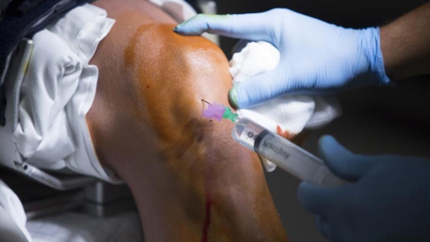 درمان ساییدگی مفاصل با تزریق ژل هیالورونیک اسید