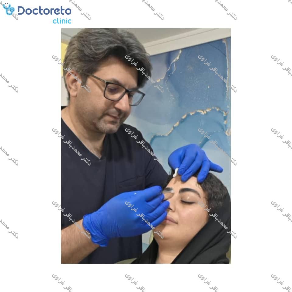 تزریق بوتاکس صورت (پیشانی، خط اخم، پنجه کلاغی)