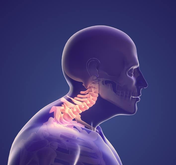 درمان آسیب‌های ورزشی و دردهای عضلانی با روش سوزن خشک (درای نیدلینگ) هرجلسه