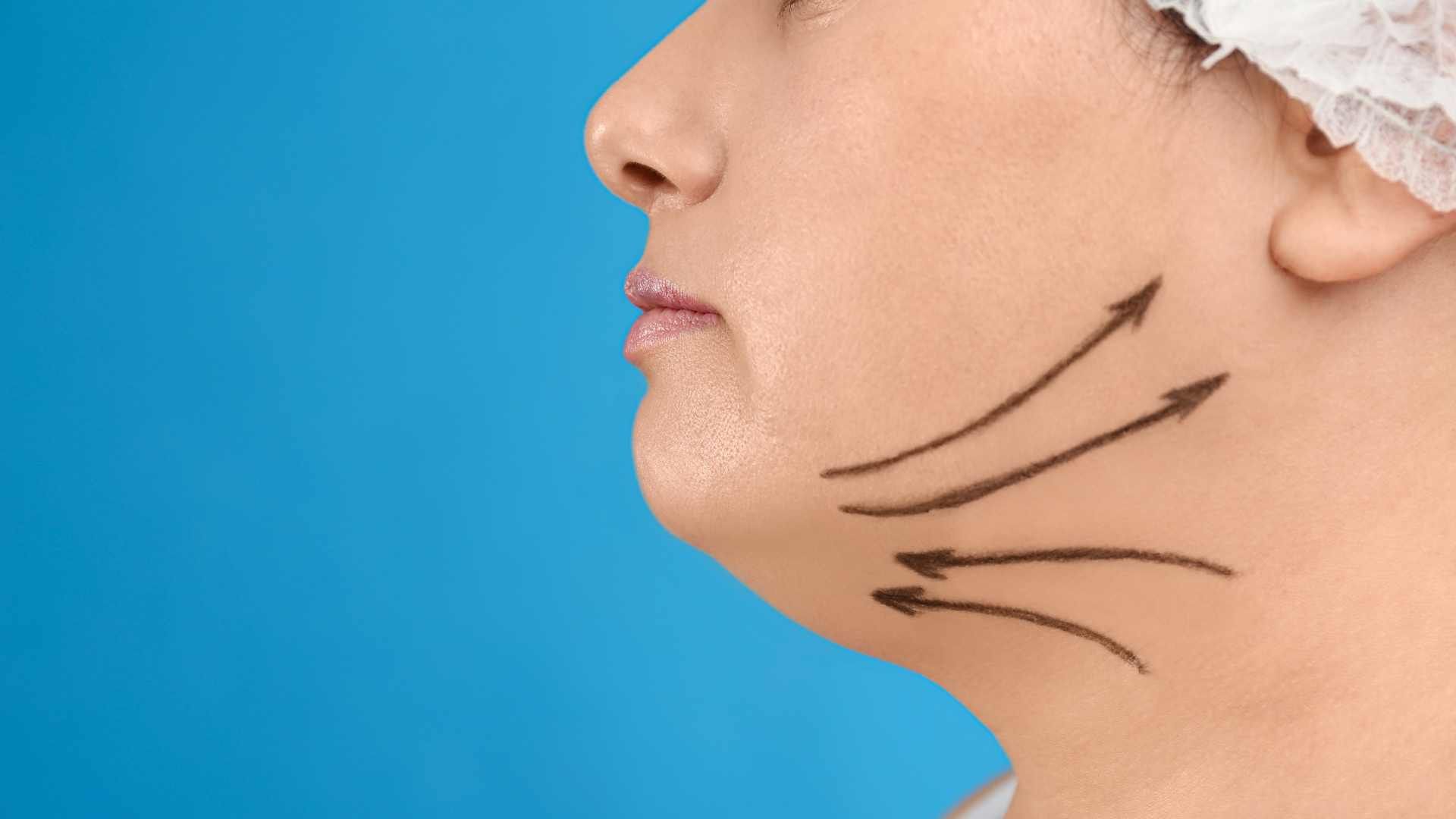 لاغری موضعی صورت به روش تزریق مزوتراپی سوز