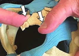 درمان دستی مشکلات دنبالچه