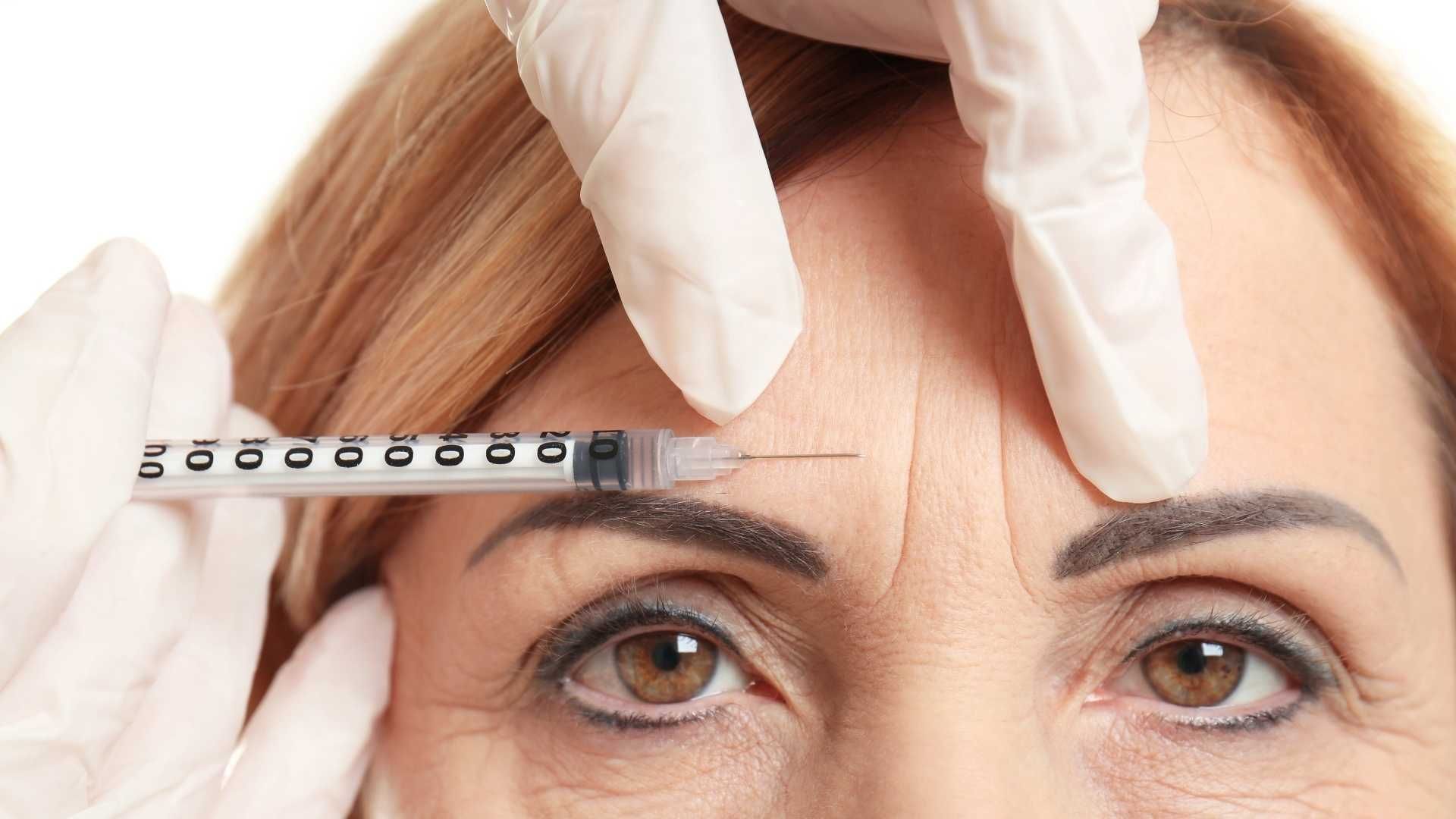 تزریق بوتاکس صورت (پیشانی، خط اخم، پنجه کلاغی)💉