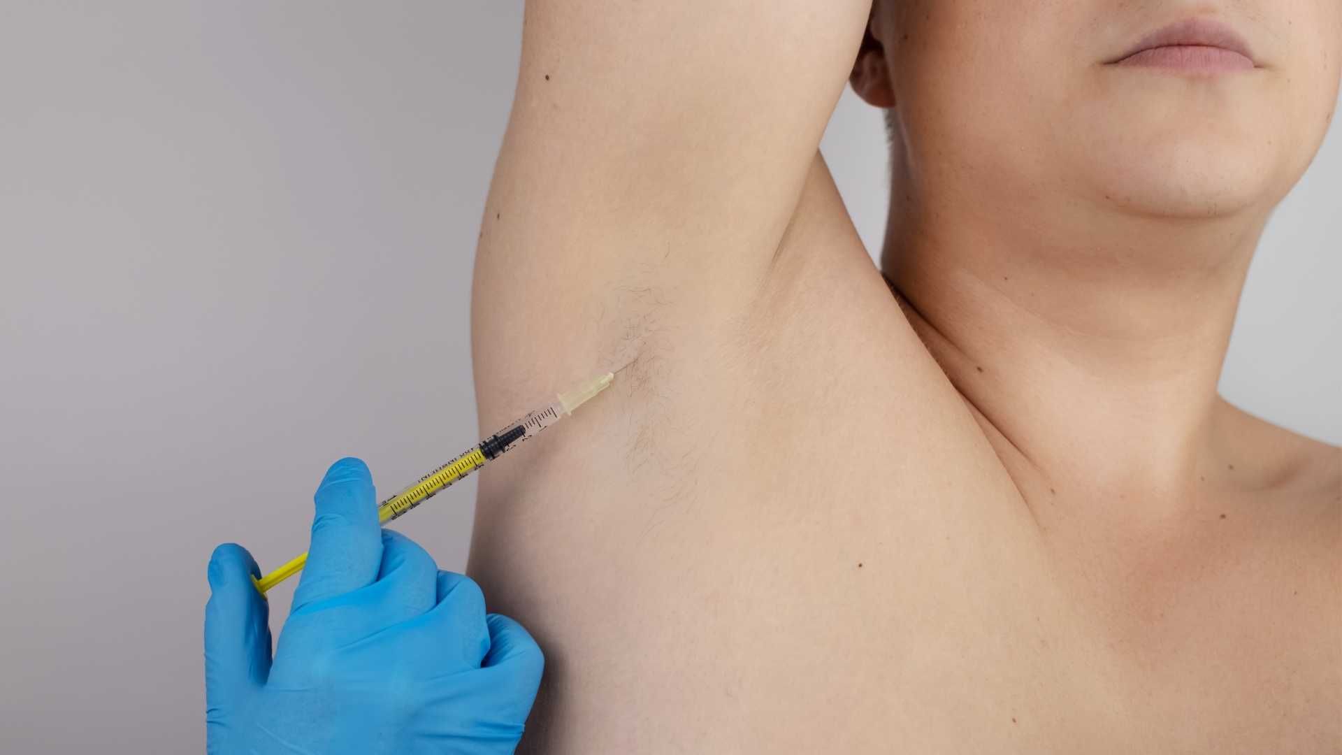 تزریق بوتاکس ضد تعریق (هایپر هیدروسیس)