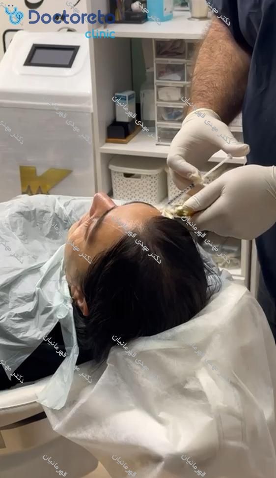 تزریق بوتاکس صورت (پیشانی، خط اخم، پنجه کلاغی)💉