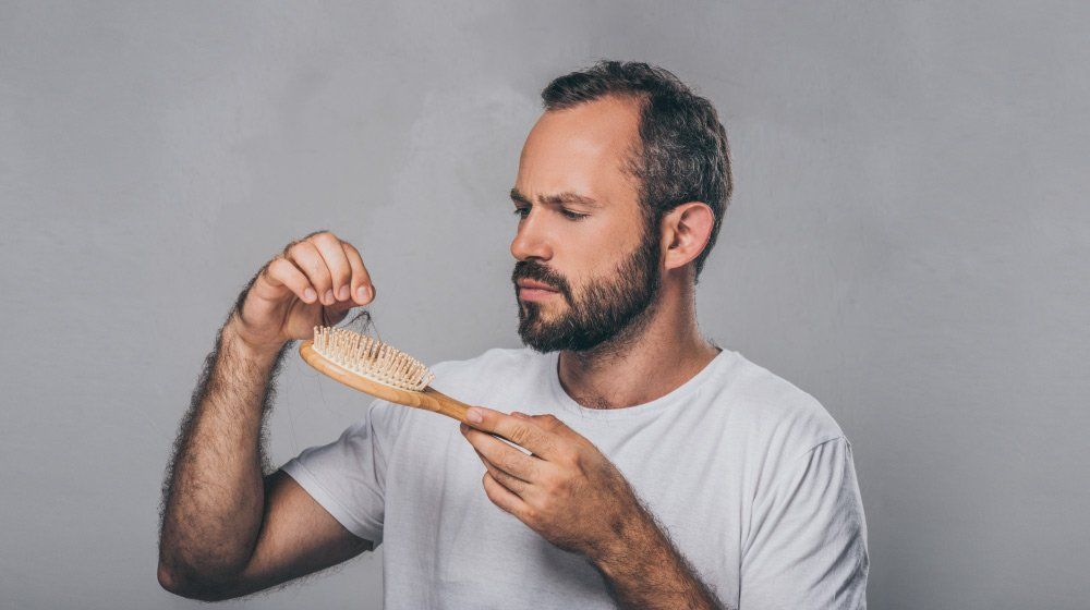 آزمایش ریزش مو در مردان