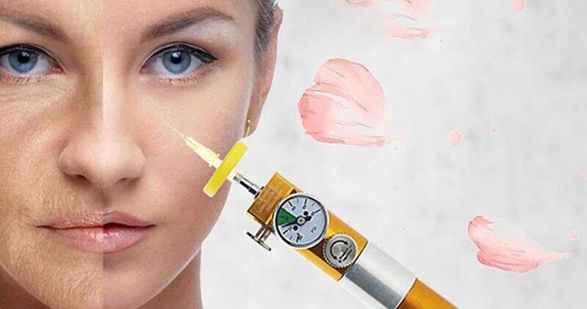 درمان پسوریازیس پوست به روش کربوکسی تراپی