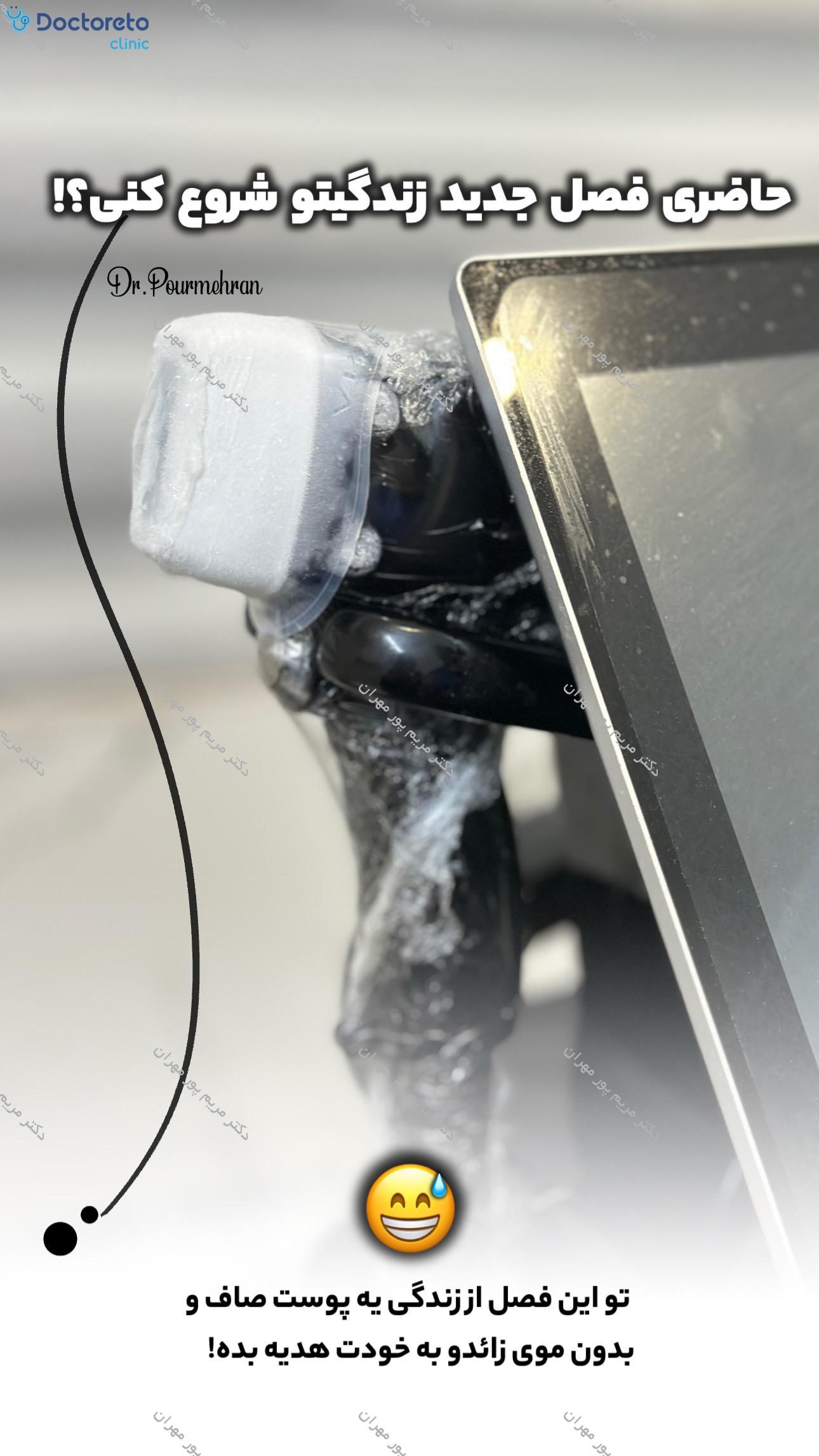 لیزر موهای زائد بانوان با دستگاه سوپرانو آیس تیتانیوم ⚡