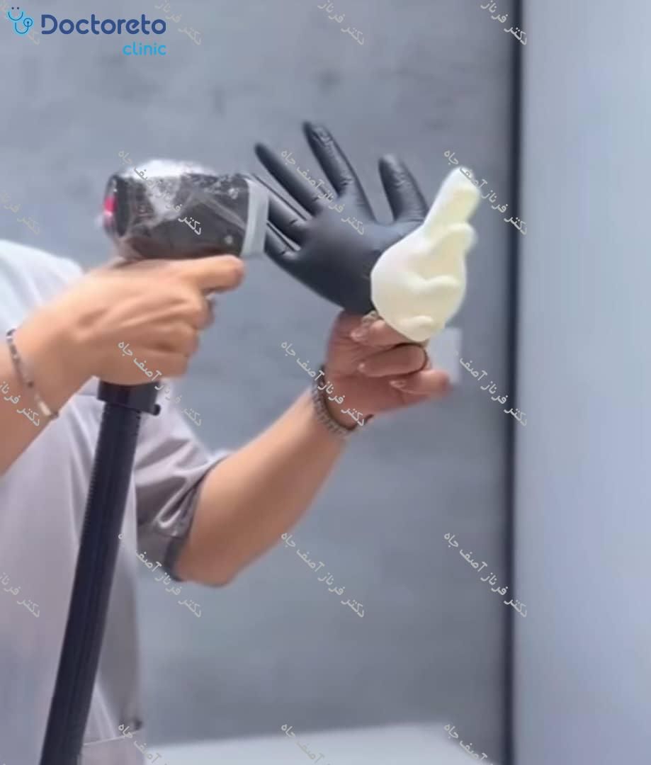 لیزر موهای زائد بانوان و آقایان با دستگاه سوپرانو آیس تیتانیوم⚡