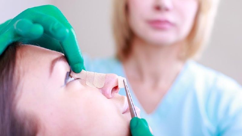 عمل زیبایی بینی نیمه فانتزی (رینوپلاستی)