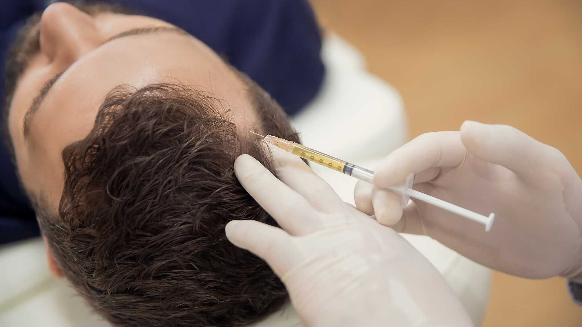 مزوتراپی ابرو (هر جلسه)