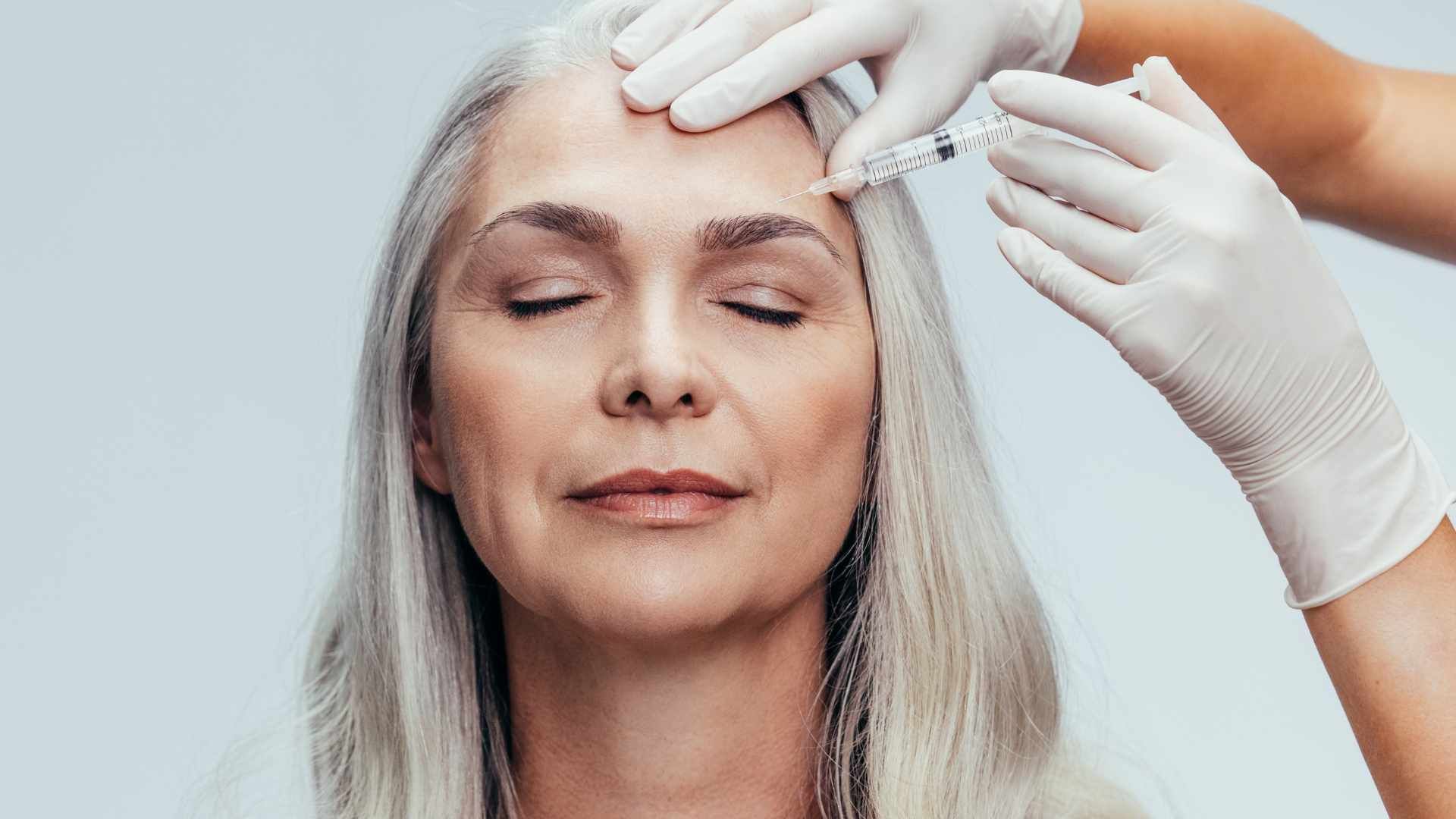 تزریق بوتاکس صورت (پیشانی، خط اخم، پنجه کلاغی)💉