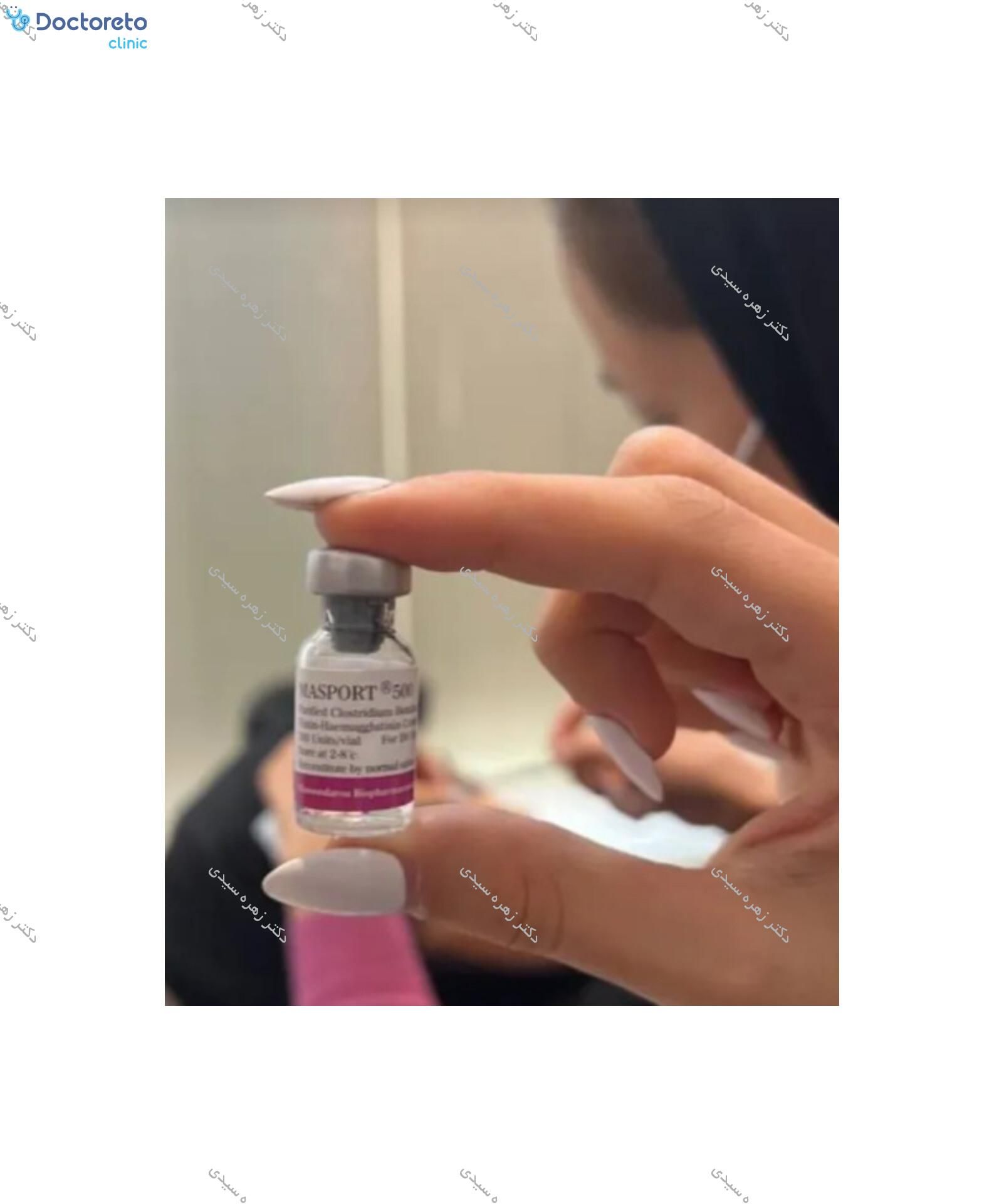 تزریق بوتاکس صورت (پیشانی، خط اخم، پنجه کلاغی)💉