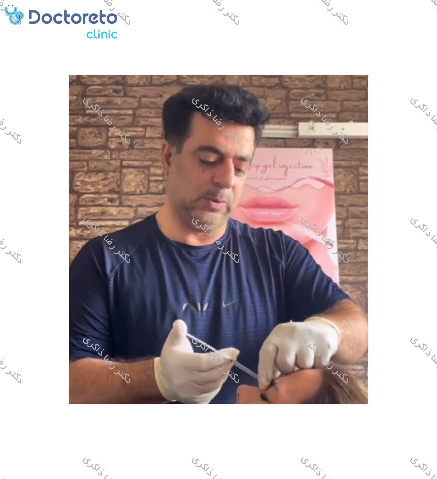 تزریق بوتاکس صورت (پیشانی، خط اخم، پنجه کلاغی)💉