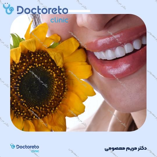 لمینت دندان (هر واحد)