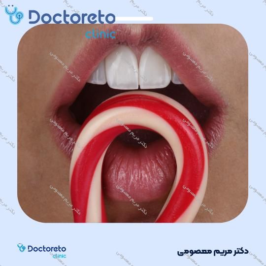 ونیر کامپوزیت (هر واحد)