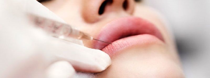 تزریق ژل لب