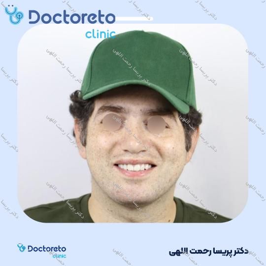 جرم گیری دو فک با بروساژ زیر لثه