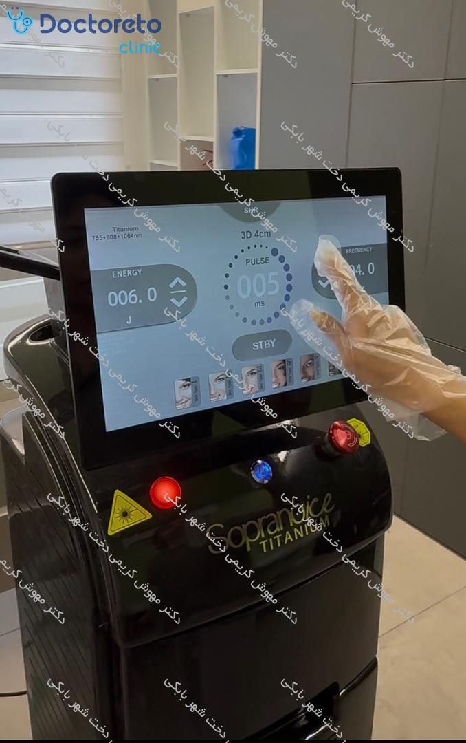 لیزر موهای زائد بانوان و آقایان با دستگاه سوپرانو آیس تیتانیوم ⚡