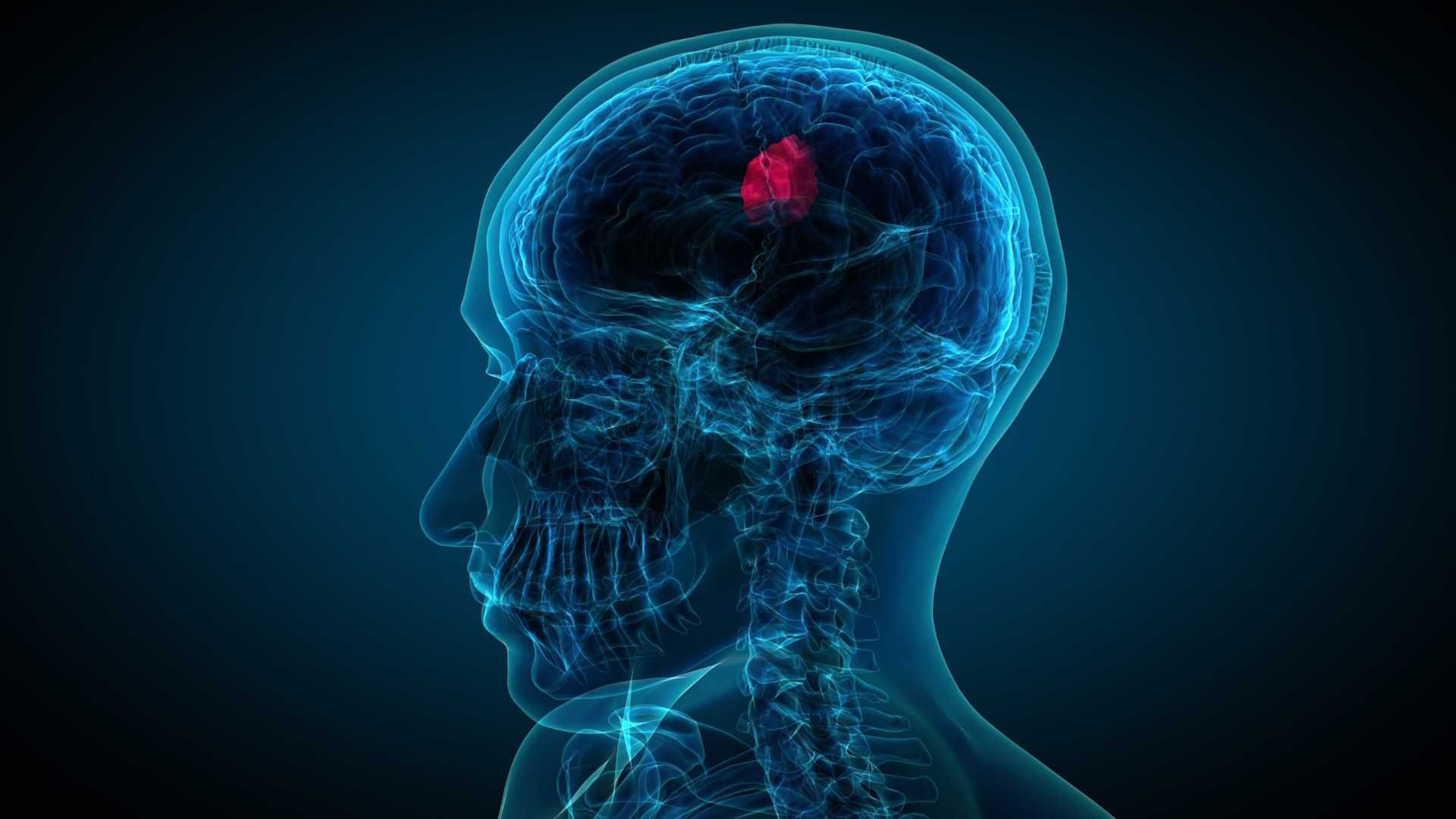 نوار مغز (EEG)