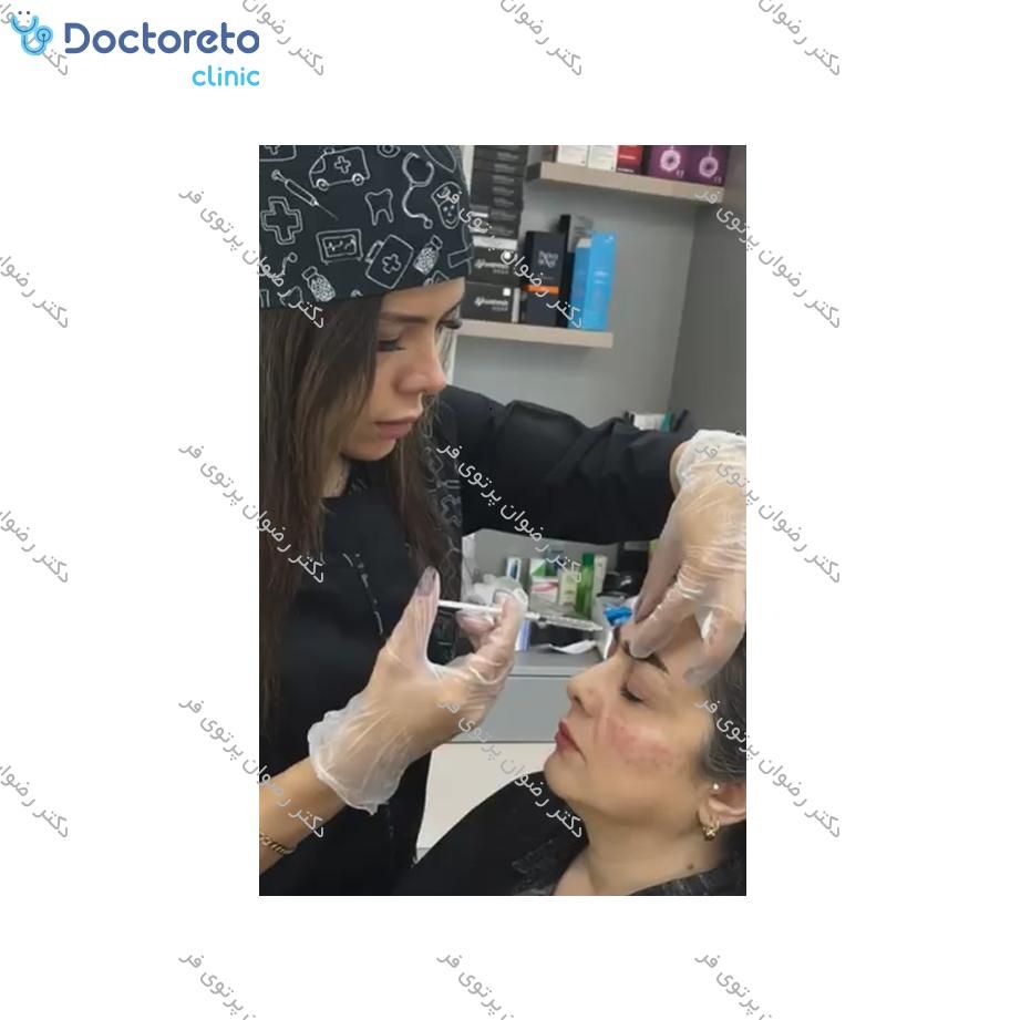تزریق بوتاکس صورت (پیشانی، خط اخم، پنجه کلاغی)💉