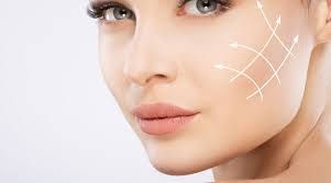 تزریق ژل گونه