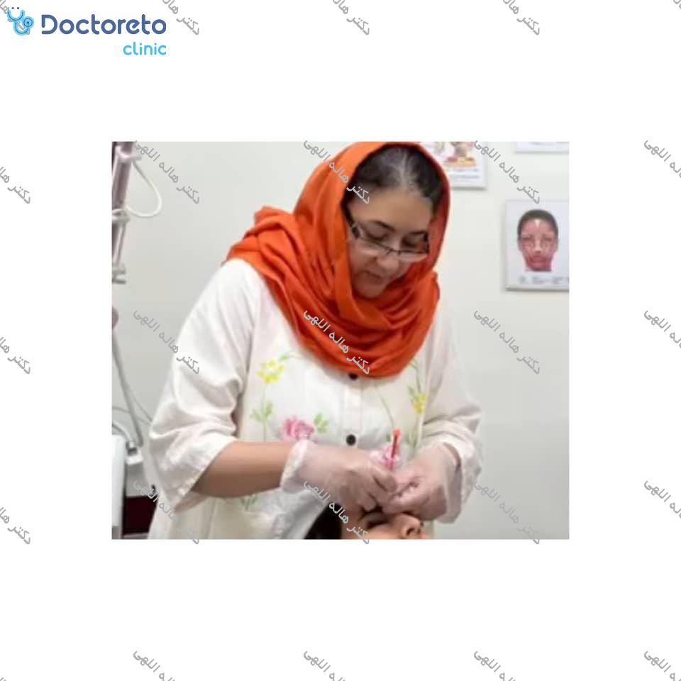 تزریق بوتاکس صورت (پیشانی، خط اخم، پنجه کلاغی)💉