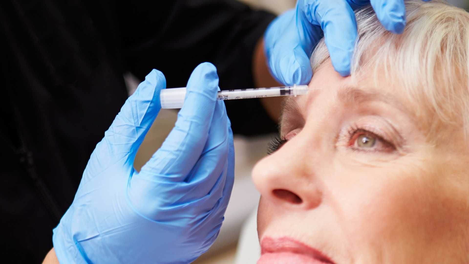 تزریق بوتاکس صورت (پیشانی، خط اخم، پنجه کلاغی)💉