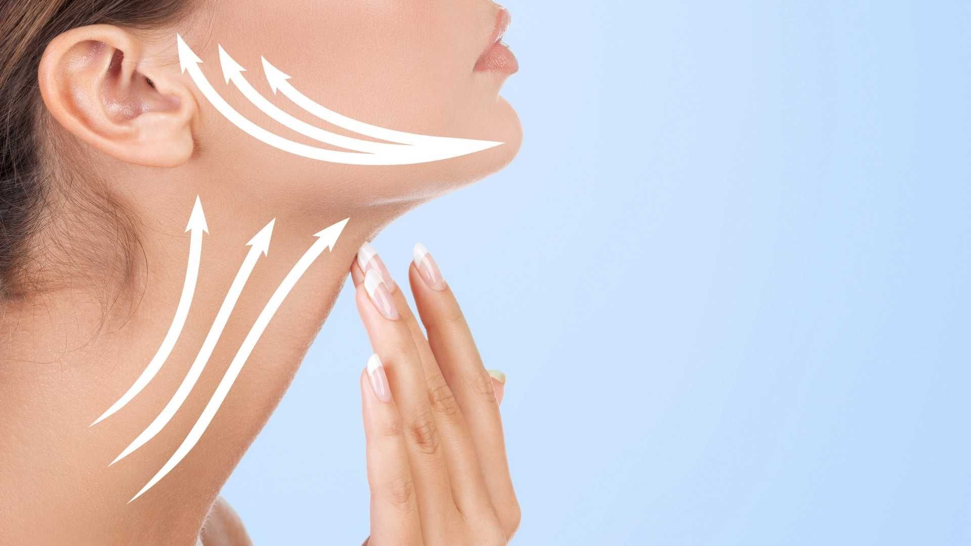 لیفت صورت RF فرکشنال