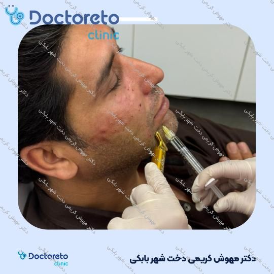 جوانسازی صورت با مزوژل