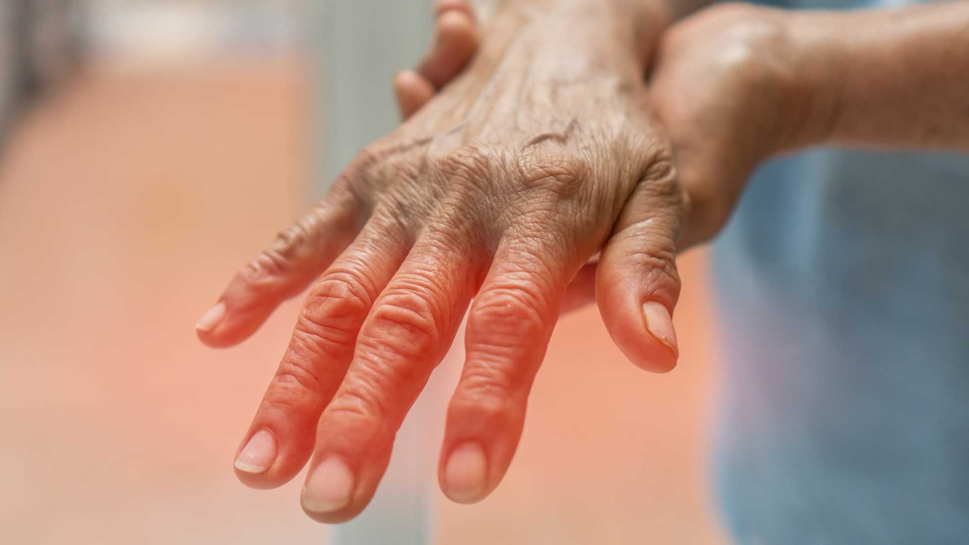 نوار عصب و عضله 4 اندام