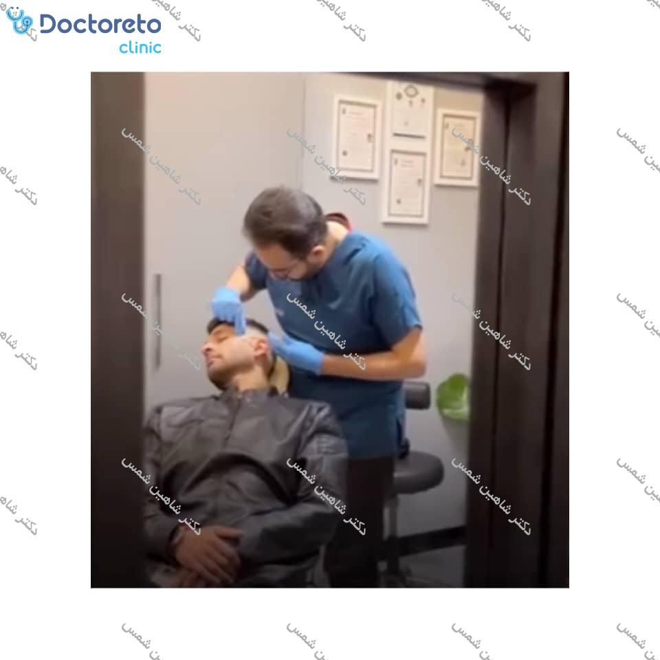 تزریق بوتاکس صورت (پیشانی، خط اخم، پنجه کلاغی)💉