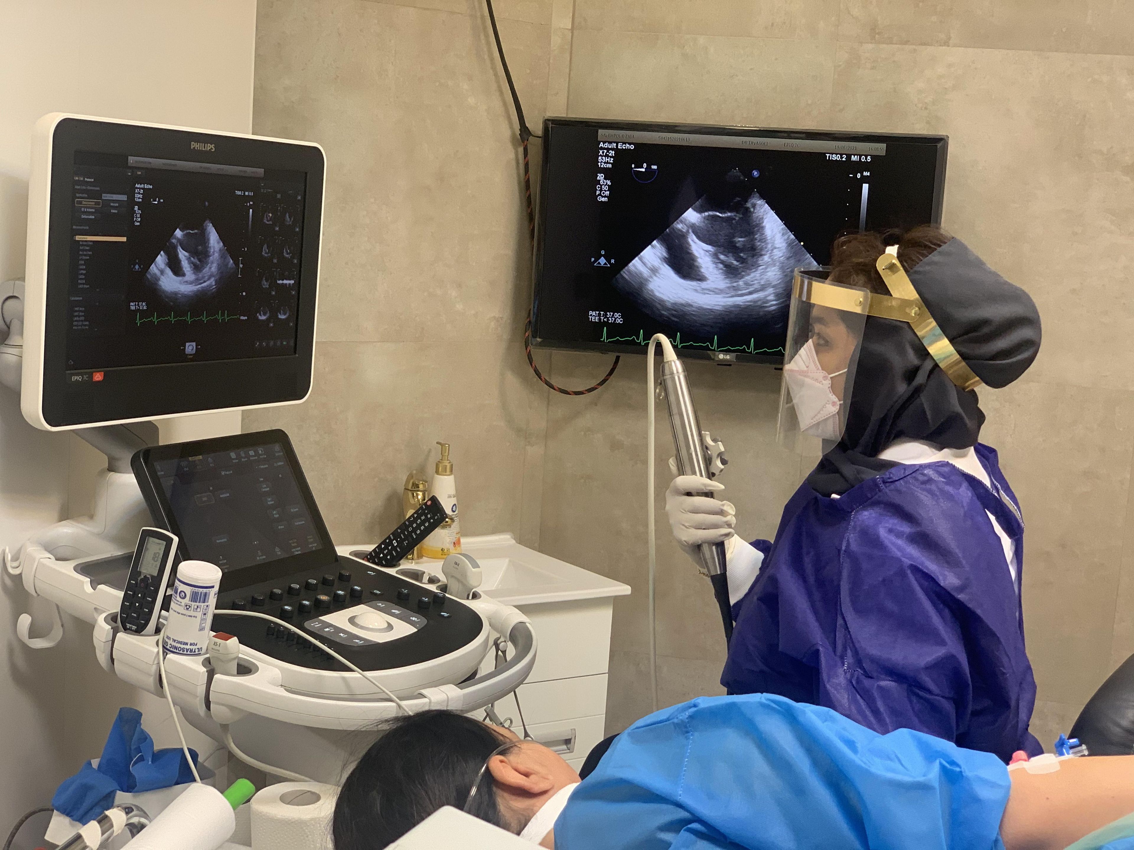 اکوکاردیوگرافی مری (4بعدی)