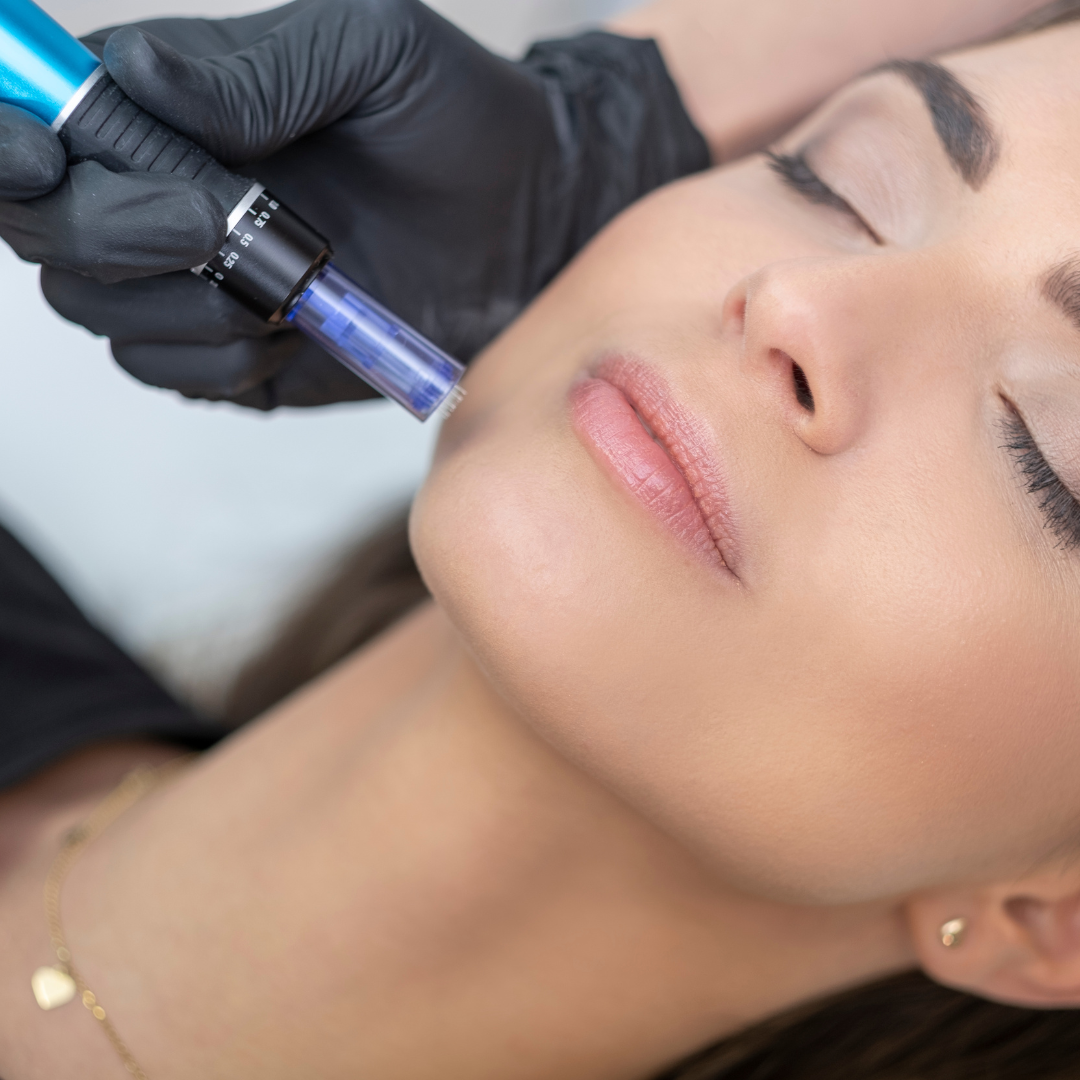 مزوتراپی صورت به همراه اگزوزوم تراپی (هر جلسه)