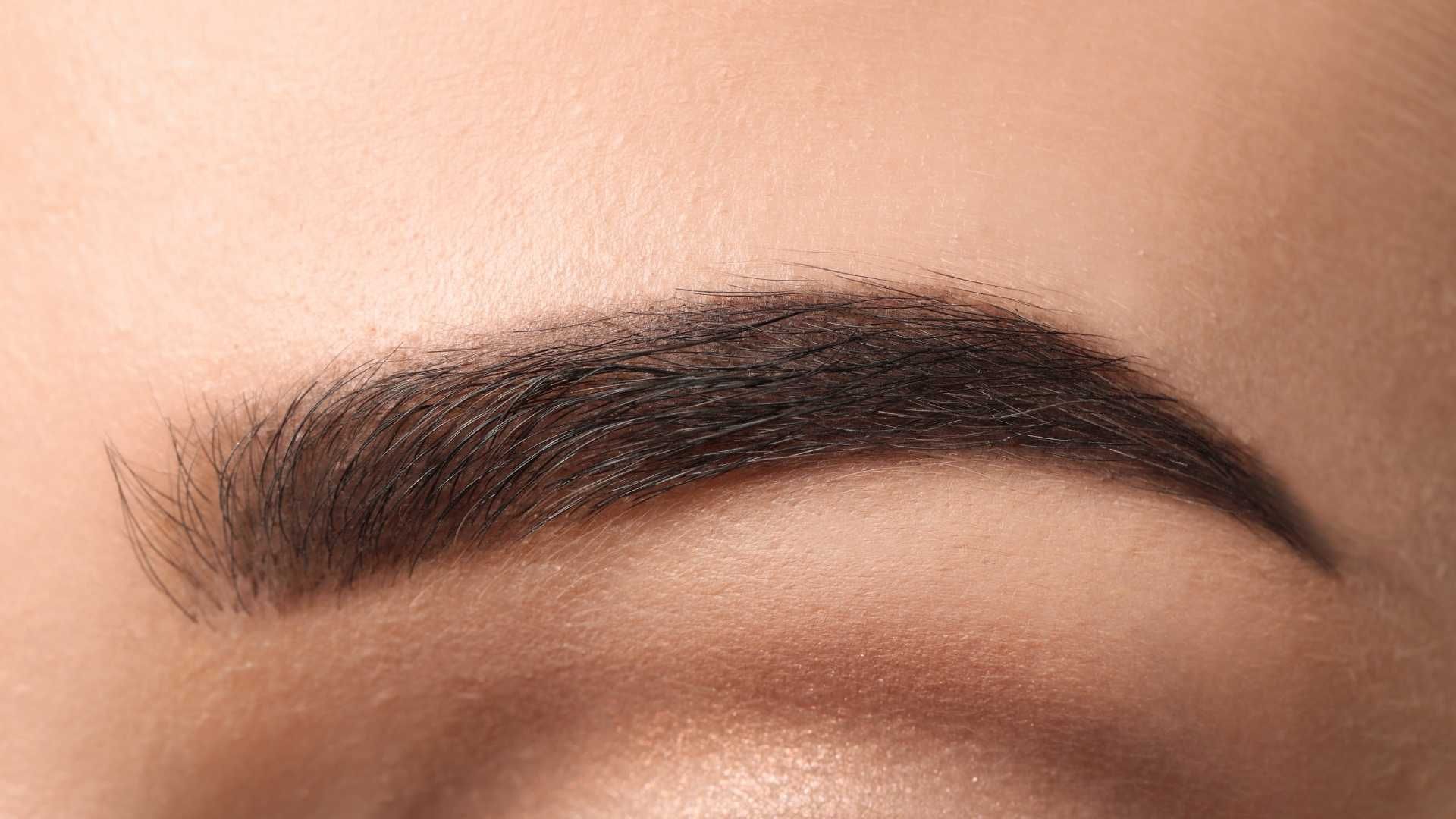 تزریق مزوتراپی ابرو