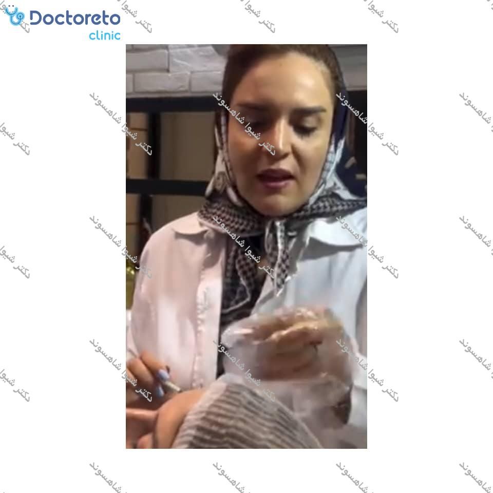 تزریق بوتاکس صورت (پیشانی، خط اخم، پنجه کلاغی)💉