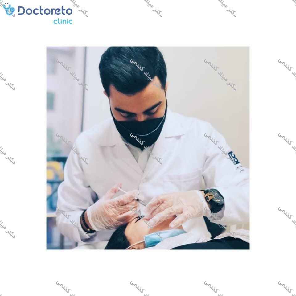تزریق بوتاکس صورت (پیشانی، خط اخم، پنجه کلاغی)💉