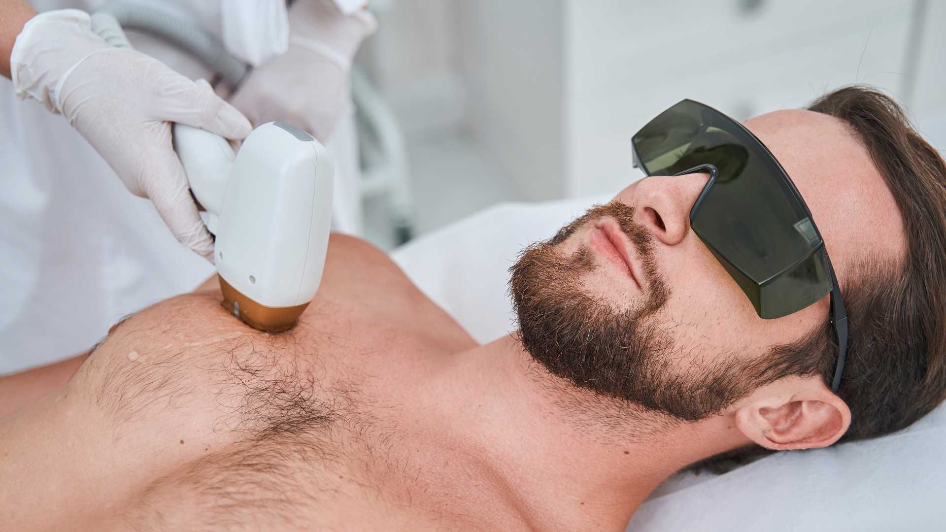 لیزر موهای زائد با دستگاه مدیو استار2022 (آقایان)