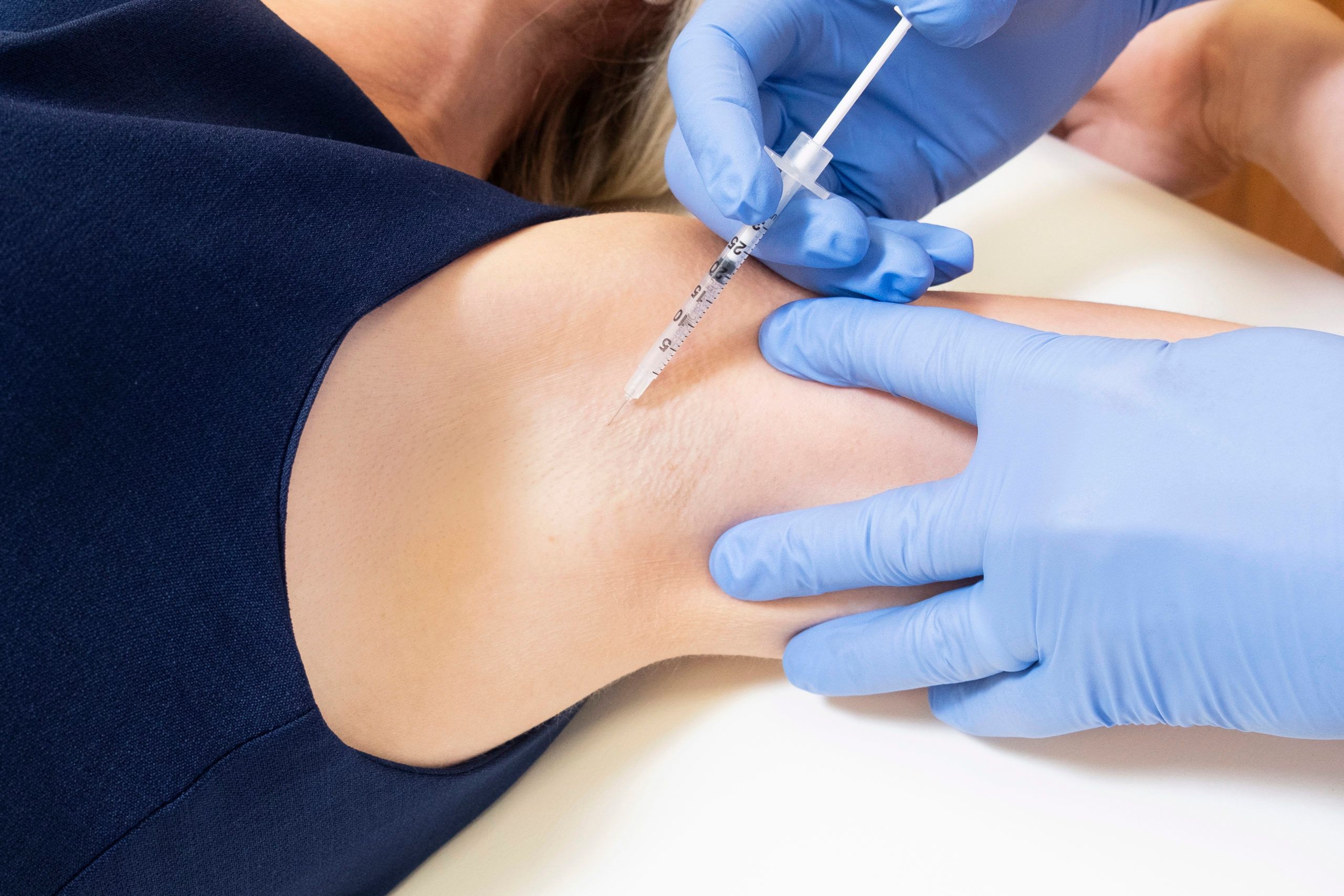 تزریق بوتاکس ضد تعریق (هایپر هیدروسیس)