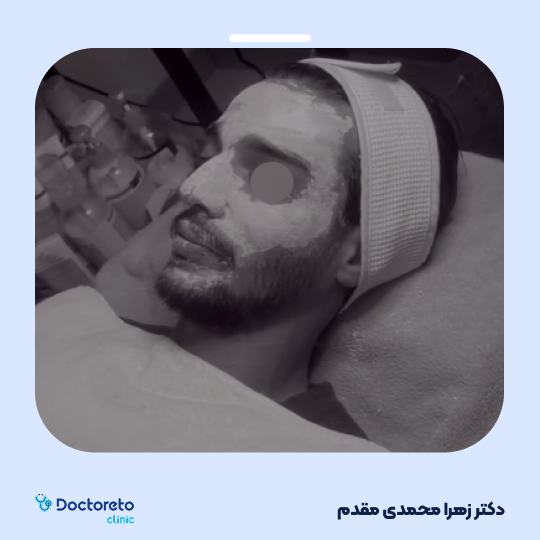 فیشیال (پاکسازی) صورت با روش VIP یا کلاسیک 💆🏻‍♀️