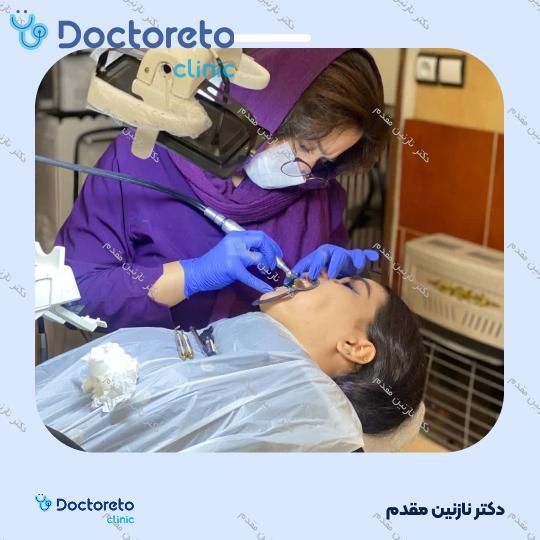 جرم گیری دندان با بروساژ🦷