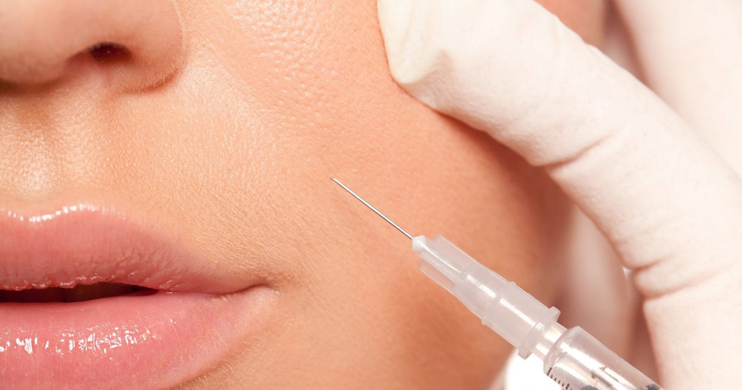 تزریق ژل خط خنده