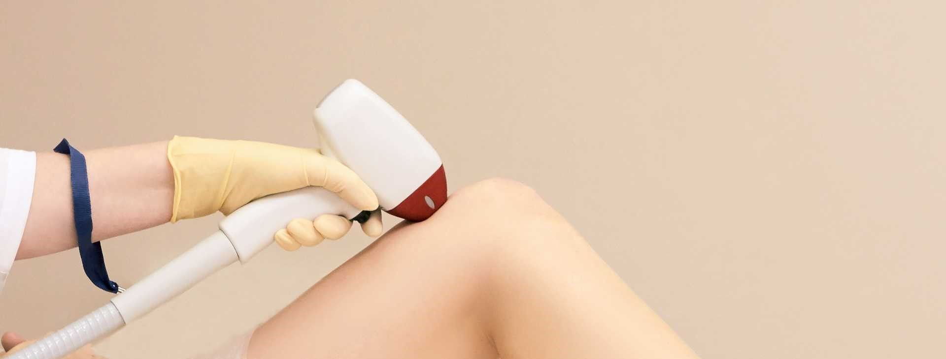 لیزر موهای زائد بانوان