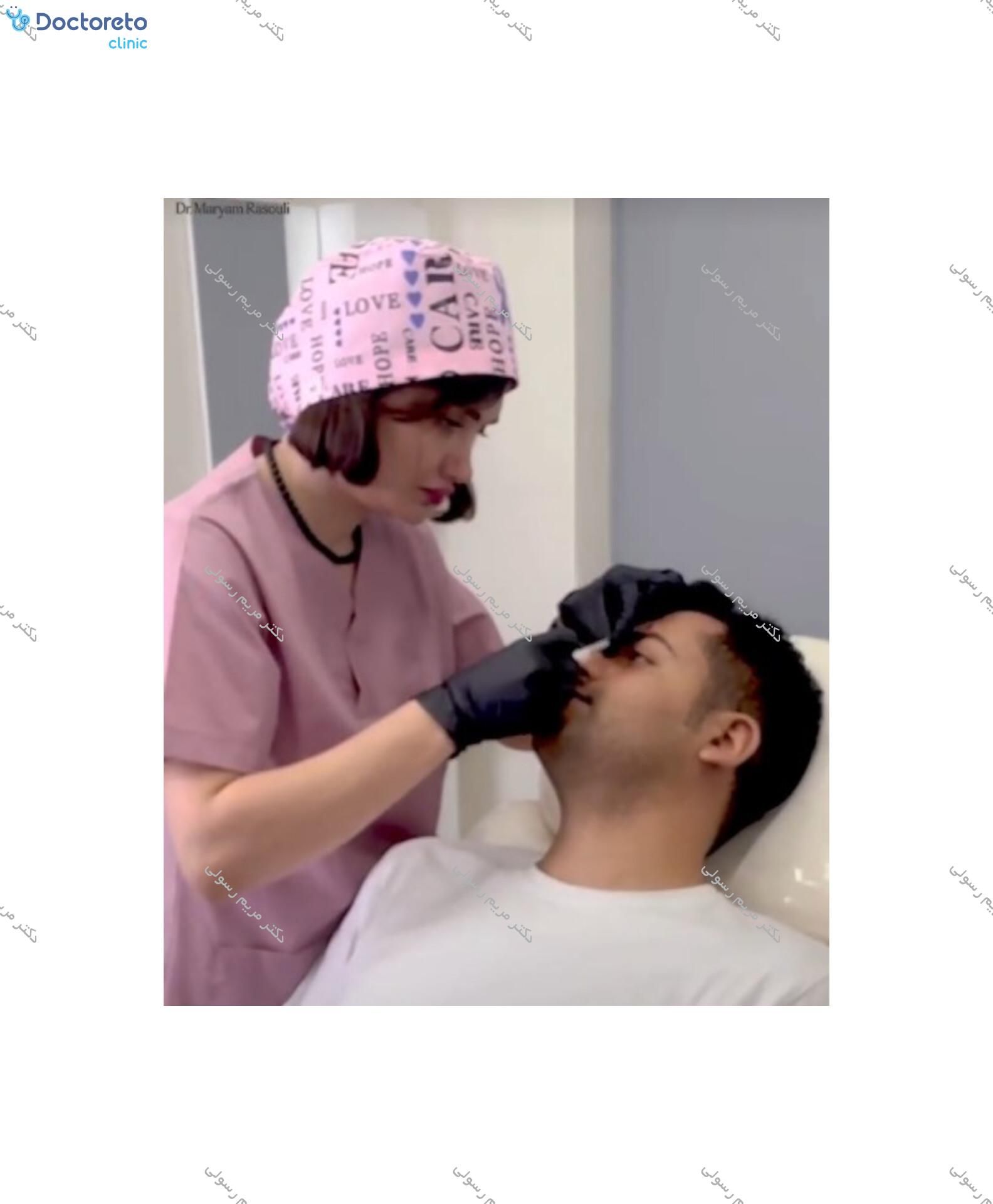 تزریق بوتاکس صورت (پیشانی، خط اخم، پنجه کلاغی)💉