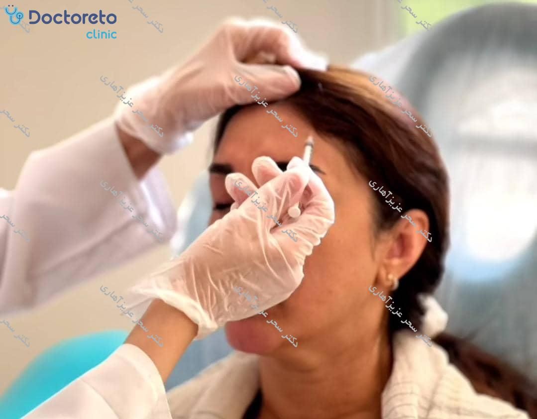 تزریق بوتاکس صورت (پیشانی، خط اخم، پنجه کلاغی)💉