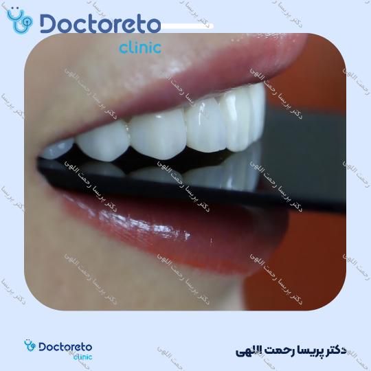 پرکردن دندان اطفال