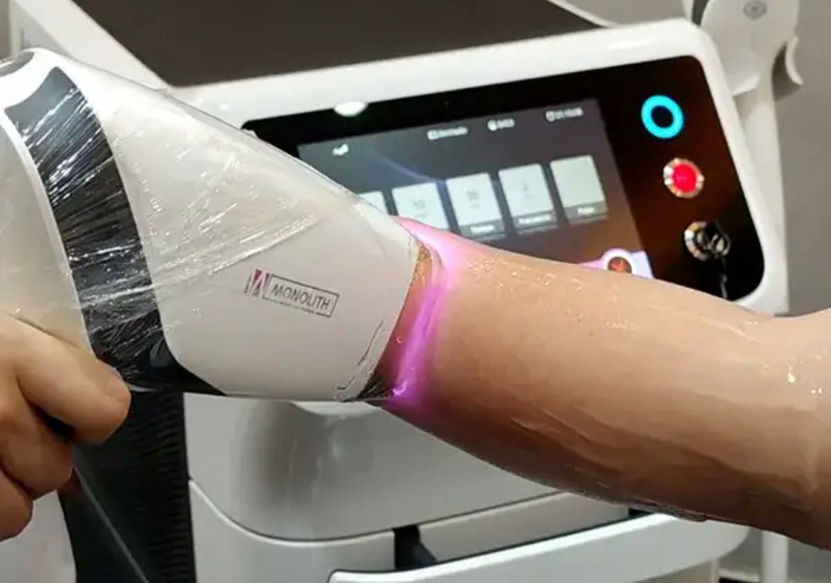 لیزر موهای زائد بانوان و آقایان با دستگاه مدیو استار ⚡